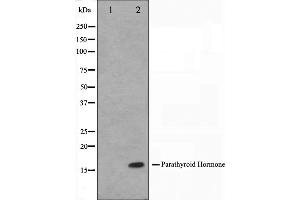 Western blot analysis on A549 cell lysate using Parathyroid Hormone Antibody. (PTH 抗体  (Internal Region))