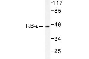 Image no. 1 for anti-Nuclear Factor of kappa Light Polypeptide Gene Enhancer in B-Cells Inhibitor, epsilon (NFKBIE) antibody (ABIN265484) (NFKBIE 抗体)