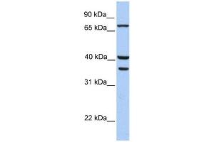 Transglutaminase 5 antibody used at 1 ug/ml to detect target protein. (Transglutaminase 5 抗体  (C-Term))