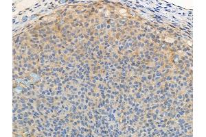 ABIN6256325 and ABIN6267117 at 1/100 staining Rat ovarian tissue by IHC-P.