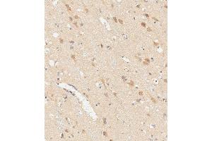 Immunohistochemical analysis of paraffin-embedded human brain tissue using (ABIN6242603 and ABIN6578838) performed on the Leica® BOND RXm. (RGMB 抗体)