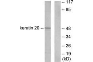 Western blot analysis of extracts from HeLa cells, using Keratin 20 Antibody. (KRT20 抗体  (AA 375-424))