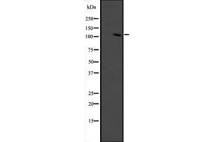 Western blot analysis of GRIP1 expression in fetal muscle lysate ,The lane on the left is treated with the antigen-specific peptide. (GRIP1 抗体  (Internal Region))