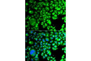 Immunofluorescence analysis of A549 cells using TBPL1 antibody (ABIN5975608). (TBPL1 抗体)