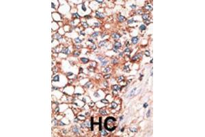 Immunohistochemistry (IHC) image for anti-Gap Junction Protein, alpha 10, 62kDa (GJa10) antibody (ABIN2998438) (GJa10 抗体)