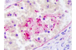 Anti-PPBP antibody IHC of human intravascular platelets. (CXCL7 抗体)