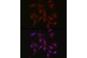 Immunofluorescence analysis of NIH-3T3 cells using PRKCB Rabbit pAb (ABIN6128462, ABIN6146199, ABIN6146201 and ABIN6217699) at dilution of 1:50 (40x lens). (PKC beta 抗体  (AA 1-270))