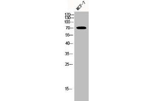 Western Blot analysis of MCF-7 cells using HSP70 Polyclonal Antibody (HSPA1L 抗体  (Internal Region))