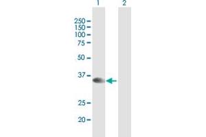 Western Blot analysis of STX16 expression in transfected 293T cell line by STX16 MaxPab polyclonal antibody. (Syntaxin 16 抗体  (AA 1-304))