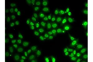 Immunofluorescence analysis of HeLa cells using EWSR1 antibody (ABIN5970844). (EWSR1 抗体)