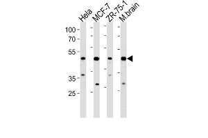 Western Blotting (WB) image for anti-F-Box Protein 28 (FBXO28) antibody (ABIN3004599) (FBXO28 抗体)