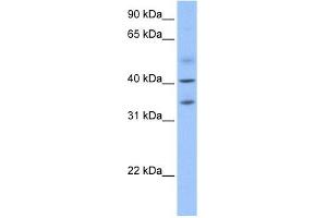 Western Blotting (WB) image for anti-Zinc Finger CCCH-Type Containing 14 (ZC3H14) (N-Term) antibody (ABIN632982)