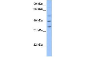 ZC3H14 antibody used at 1 ug/ml to detect target protein. (ZC3H14 抗体  (N-Term))