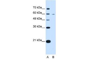 KYNU antibody used at 0. (KYNU 抗体)