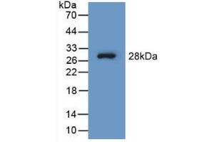 Western Blotting (WB) image for Phenylalanine Hydroxylase ELISA Kit (ABIN6720497)