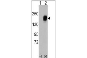 Western blot analysis of EGFR (arrow) using rabbit polyclonal EGFR Antibody i. (EGFR 抗体  (AA 956-985))
