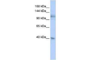 MSH2 antibody used at 1 ug/ml to detect target protein. (MSH2 抗体)