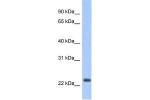 Western Blotting (WB) image for anti-Mitochondrially Encoded NADH Dehydrogenase 6 (MT-ND6) antibody (ABIN2459383) (MT-ND6 抗体)