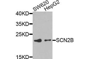 Western blot analysis of extracts of SW620 and HepG2 cells, using SCN2B antibody. (SCN2B 抗体)