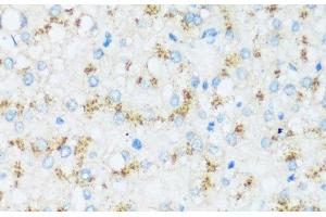 Immunohistochemistry of paraffin-embedded Human liver using APOD Polyclonal Antibody at dilution of 1:100 (40x lens). (Apolipoprotein D 抗体)