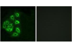 Immunofluorescence analysis of HeLa cells, using PI3-kinase p85-alpha/gamma (Ab-467/199) Antibody. (PI3K p85 alpha/gamma 抗体  (AA 436-485))