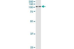 Immunoprecipitation of GSN transfected lysate using anti-GSN monoclonal antibody and Protein A Magnetic Bead , and immunoblotted with GSN MaxPab rabbit polyclonal antibody.