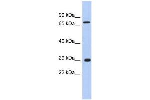 AKTIP antibody used at 1 ug/ml to detect target protein. (AKTIP 抗体  (Middle Region))