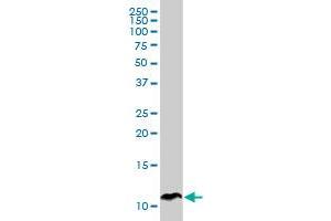 Western Blotting (WB) image for anti-serine Peptidase Inhibitor, Kazal Type 1 (SPINK1) (AA 24-79) antibody (ABIN562978)