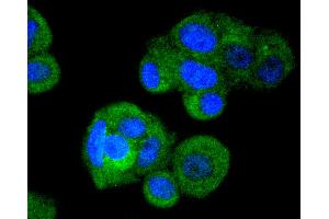 MCF-7 cells were stained with IRF3 (4C3) Monoclonal Antibody  at [1:200] incubated overnight at 4C, followed by secondary antibody incubation, DAPI staining of the nuclei and detection. (IRF3 抗体)