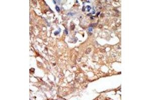 Image no. 2 for anti-V-Raf-1 Murine Leukemia Viral Oncogene Homolog 1 (RAF1) (N-Term) antibody (ABIN360145) (RAF1 抗体  (N-Term))