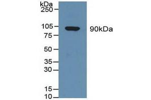 Detection of GSN in Human Serum using Polyclonal Antibody to Gelsolin (GSN) (Gelsolin 抗体  (AA 674-782))