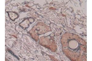 DAB staining on IHC-P; Samples: Rat Skin Tissue (PNOC 抗体  (AA 12-181))