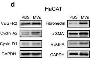Effect of ASC-MV treatment on gene expression in all three kinds of cells. (VEGFR2/CD309 抗体  (AA 1150-1250))