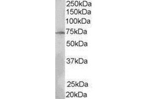 Western Blotting (WB) image for anti-SH2B Adaptor Protein 3 (SH2B3) (N-Term) antibody (ABIN2475350) (SH2B3 抗体  (N-Term))