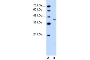 DHODH antibody used at 0. (DHODH 抗体  (C-Term))