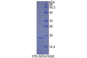 SDS-PAGE analysis of Human Cyclophilin A Protein. (PPIA 蛋白)