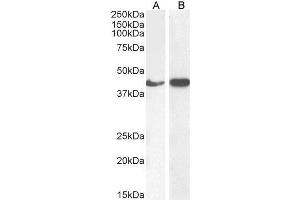 Western Blotting (WB) image for anti-Actin, alpha 2, Smooth Muscle, Aorta (ACTA2) (N-Term) antibody (ABIN185271)