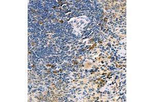 Immunohistochemistry of paraffin embedded rat spleen using UBE2J1 (ABIN7076117) at dilution of 1:400 (400x lens) (UBE2J1 抗体)