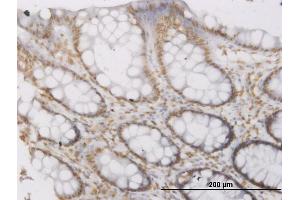 Immunoperoxidase of monoclonal antibody to ROPN1 on formalin-fixed paraffin-embedded human colon. (ROPN1 抗体  (AA 1-120))