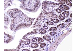 IHC analysis of MED18 using anti-MED18 antibody . (MED18 抗体  (AA 1-208))
