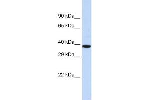 Host:  Rabbit  Target Name:  NOX4  Sample Type:  MCF7 Whole Cell lysates  Antibody Dilution:  1. (NADPH Oxidase 4 抗体  (Middle Region))