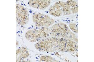 Immunohistochemistry of paraffin-embedded human stomach using MTERFD3 antibody (ABIN5974877) at dilution of 1/100 (40x lens). (MTERFD3 抗体)