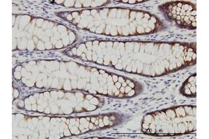 Image no. 1 for anti-WNK Lysine Deficient Protein Kinase 2 (WNK2) (AA 2118-2218) antibody (ABIN599299) (WNK2 抗体  (AA 2118-2218))