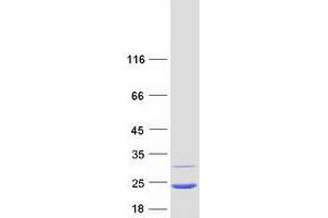 MRPL12 Protein (Myc-DYKDDDDK Tag)