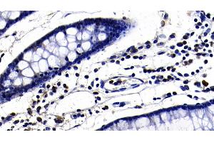 Immunohistochemistry (IHC) image for anti-Toll-Like Receptor 3 (TLR3) (AA 404-532) antibody (ABIN7434491)
