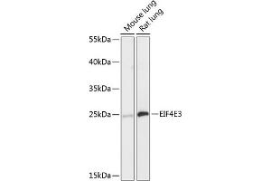 Western blot analysis of extracts of various cell lines, using EIF4E3 antibody (ABIN6130367, ABIN6140088, ABIN6140089 and ABIN6218034) at 1:3000 dilution. (EIF4E3 抗体  (AA 1-118))