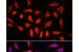 Immunofluorescence analysis of U-2 OS cells using IRF1 Polyclonal Antibody at dilution of 1:100. (IRF1 抗体)