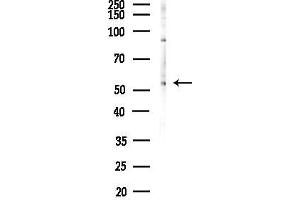 Western blot analysis of lysates from HUVEC cells(LPS,4h treatment), using K Antibody at 1/1000 dilution.