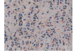IHC-P analysis of Human Prostate Gland Tissue, with DAB staining. (FAM3C 抗体  (AA 25-227))