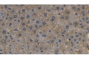 Detection of LRG1 in Rat Liver Tissue using Monoclonal Antibody to Leucine Rich Alpha-2-Glycoprotein 1 (LRG1) (LRG1 抗体  (AA 39-308))